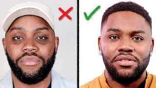 Remove DARK CIRCLES Under Your Eyes How I Did It Mens Skin Care [upl. by Airetal]