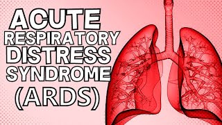 Acute Respiratory Distress Syndrome ARDS [upl. by Dibri360]