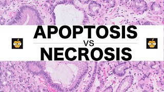 Apoptosis Intrinsic Extrinsic Pathways vs Necrosis [upl. by Innig]