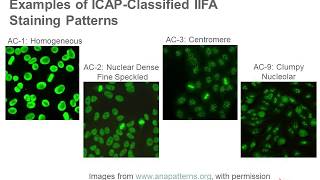 Antinuclear Antibody Testing [upl. by Dal]