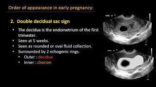 Advanced screening views of the fetal heart  Part 1  4chamber color and PW Doppler [upl. by Marti160]