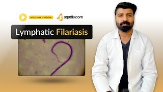 Lymphatic Filariasis  Medicine Lectures  Medical Student  VLearning  sqadiacom [upl. by Chariot]