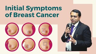 What are the Initial Symptoms of Breast Cancer  Dr Manish Singhal [upl. by Ahsienar125]