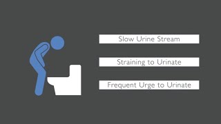 Trouble Urinating What Causes Urinary Issues in Men [upl. by Naara]