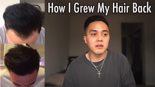 How I Grew My Hair Back  My Hair Loss Journey and Treatment [upl. by Phaih690]