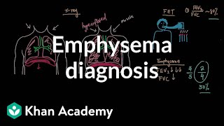 Emphysema diagnosis  Respiratory system diseases  NCLEXRN  Khan Academy [upl. by Saree]