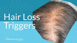 Common Hair Loss Triggers [upl. by Noemi318]