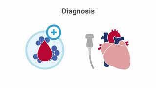 Endocarditis 101 Diagnosis and Treatment [upl. by Anon]