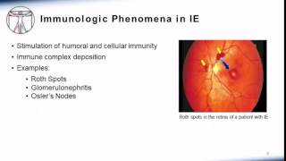 Endocarditis Clinical Manifestation [upl. by Magee491]