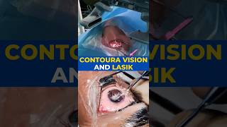 Contoura Vision And Lasik Surgery [upl. by Lyrehs]