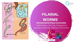 Filarial worms Wuchereria bancrofti Brugia malayi Mansonia Loa loa Onchocerca volvulus ampmore [upl. by Plossl]