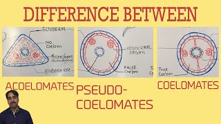 Acoelomates Pseudocoelomates and coelomates  Triploblastic organisation [upl. by Amathiste]