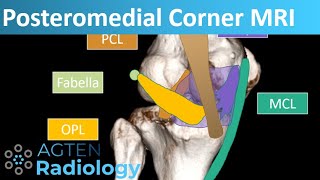 Posteromedial Corner Anatomy on Knee MRI [upl. by Eannyl112]