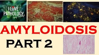 AMYLOIDOSIS Part 1 Definition Historical aspects amp Properties of Amyloid [upl. by Horlacher115]