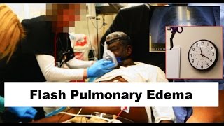 Flash Pulmonary Edema Emergency [upl. by Thrift995]