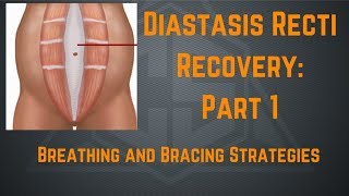 Diastasis Recti Recovery Part 1 Breathing and Bracing Strategies [upl. by Naired]