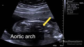 Ultrasound Principles amp Instrumentation  Orientation amp Imaging Planes [upl. by Aihcsrop332]