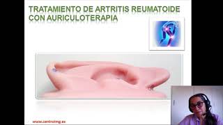 22 Artritis reumatoide Tratamiento con Auriculoterapia Centro IMG [upl. by Narmis834]